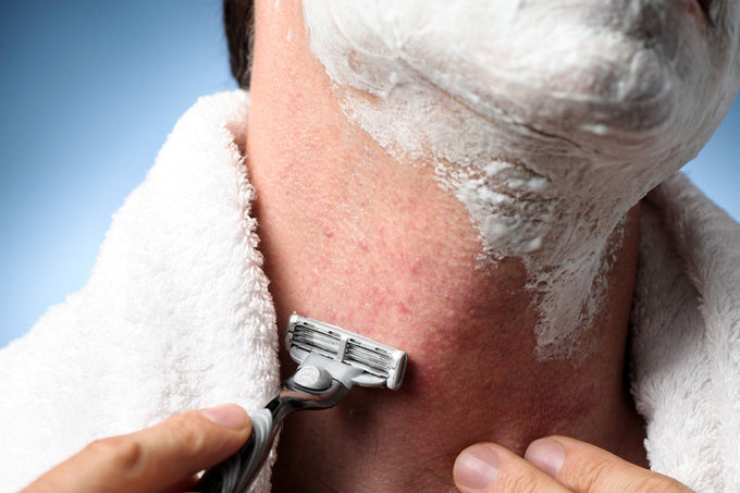 8 Tips on How to Get Rid of Razor Burn and Razor Rash